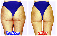 �{�p�O�E��